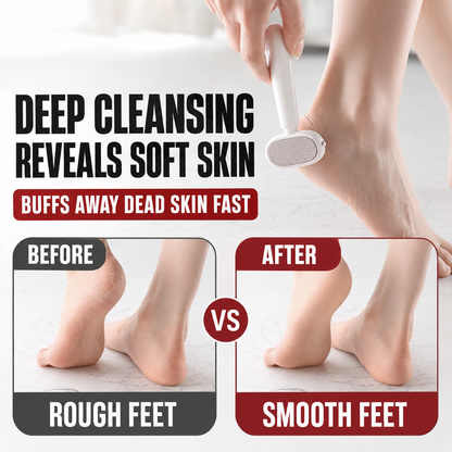 2-in-1 Precision Foot File