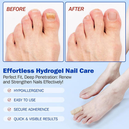 Hydrogel Nail Care Patches | Overnight Toe & Nail Repair Support for Smoother-Looking Nails